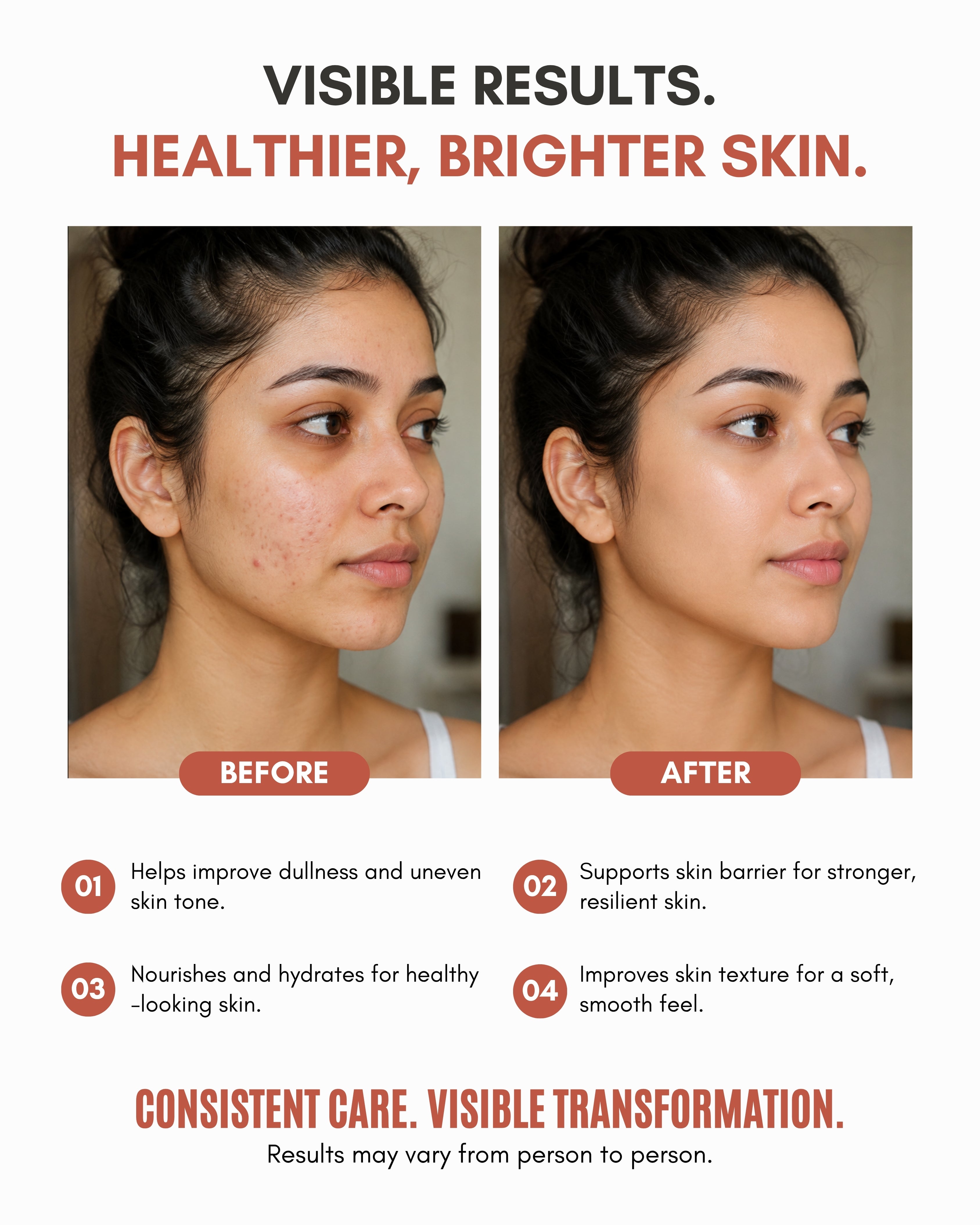 Veloni Advanced Brightening Cream | Daily Skin Radiance & Even Tone Moisturizer