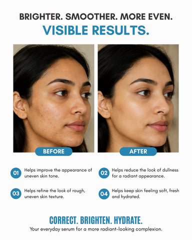 Veloni Advanced Corrective Serum | Niacinamide & Tranexamic Acid Face Serum
