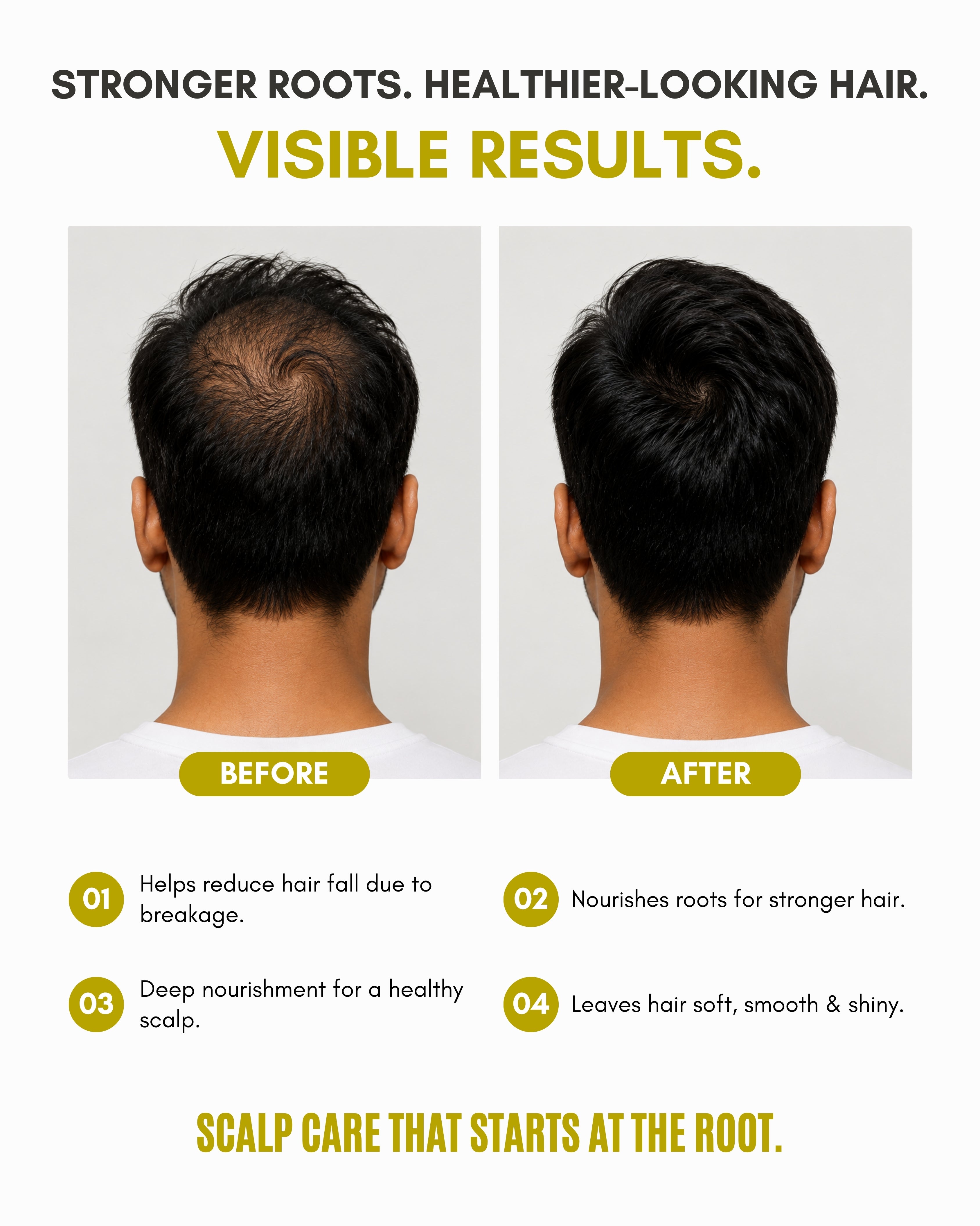 Veloni Advanced Scalp Care Oil | Multi-Oil Root Complex Hair Oil