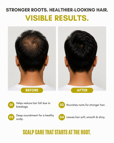 Veloni Advanced Scalp Care Oil | Multi-Oil Root Complex Hair Oil