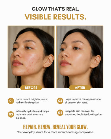 Veloni Glow Repair Bi-Phase Serum | Vitamin C, Niacinamide & Bakuchiol Face Serum