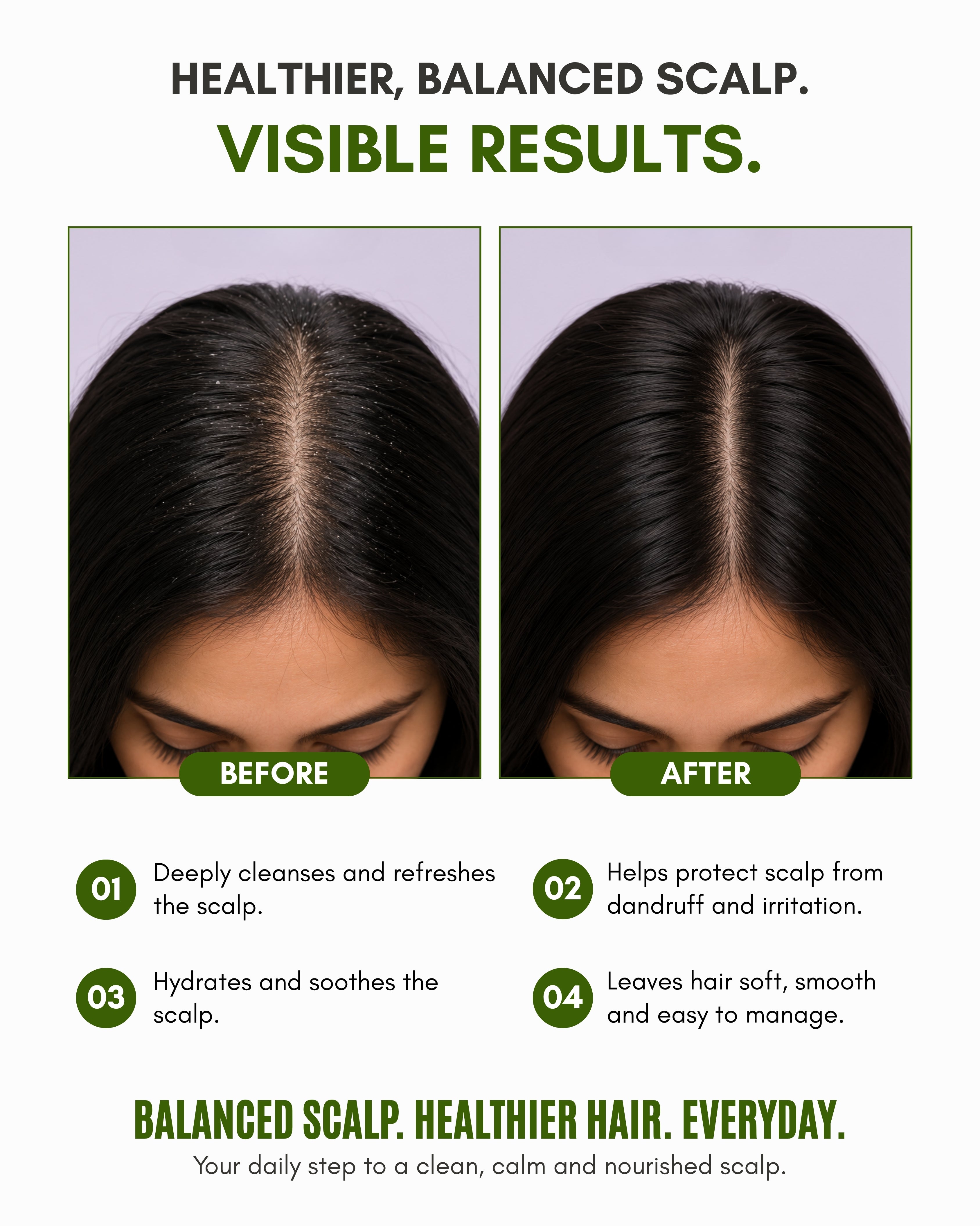 Veloni Scalp Balance Shampoo | Scalp Nourishing Formula for Healthy Hair