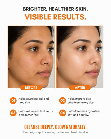 Veloni Vitamin C Serum  Niacinamide + Alpha Arbutin